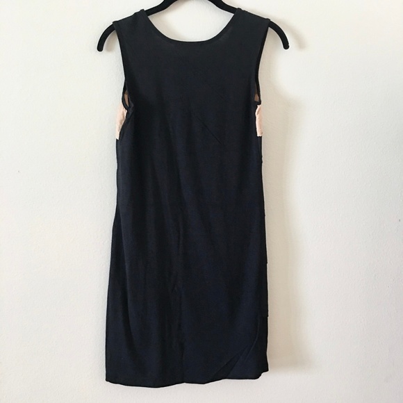 See By Chloe Dress 2 - Picture 3 of 8